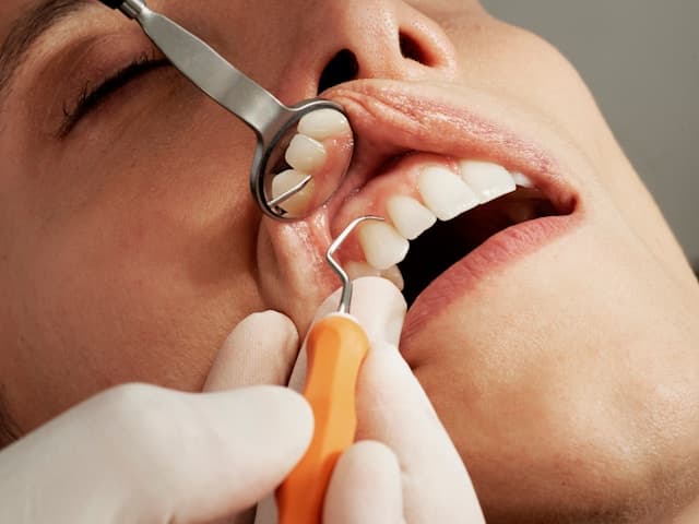 Periodontal Treatment